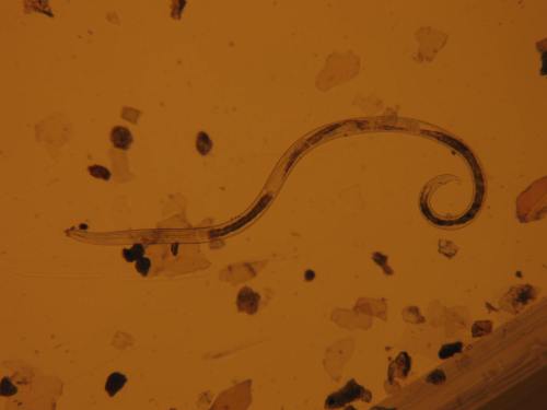 One of the many nematodes (microscopic worms) that lives in the Dry Valleys.